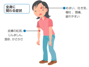 シックハウス症候群とは